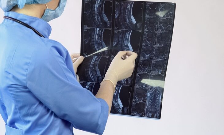 Emakakaela osteokondroosi diagnoos tehakse MRI uuringu põhjal